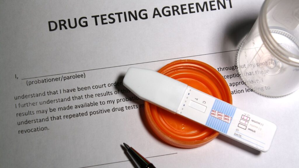 Why is Drug Testing Necessary in Today’s Workplace?